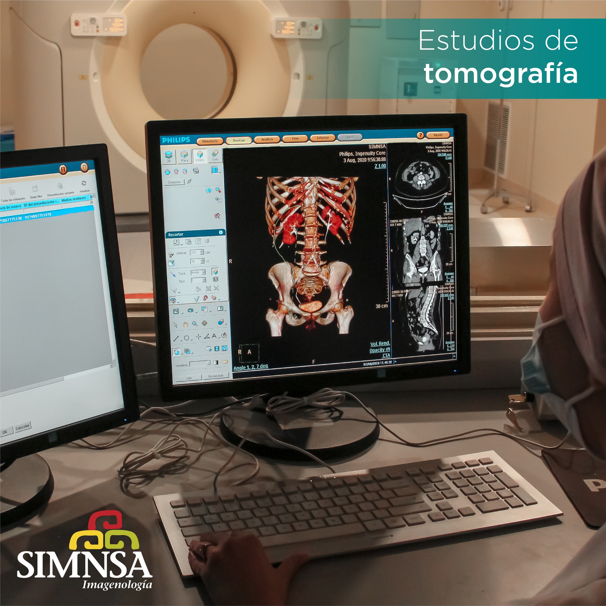 La tomografía es una herramienta... - Simnsa Health Care