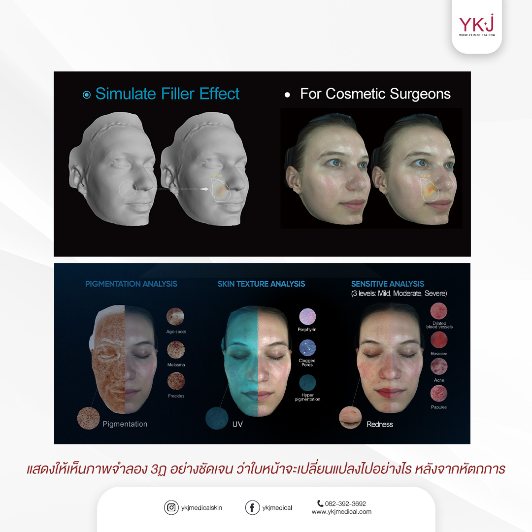 🔥... - YKJ Medical โปรแกรมฺฟิลเลอร์ Botox เลเซอร์ ร้อยไหม | Facebook