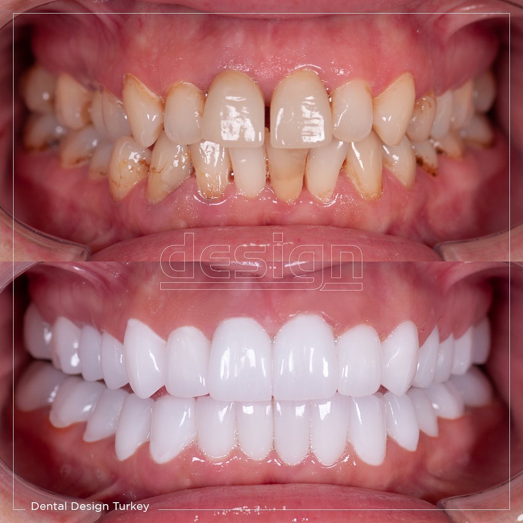 Dental Design Turkey Home Facebook