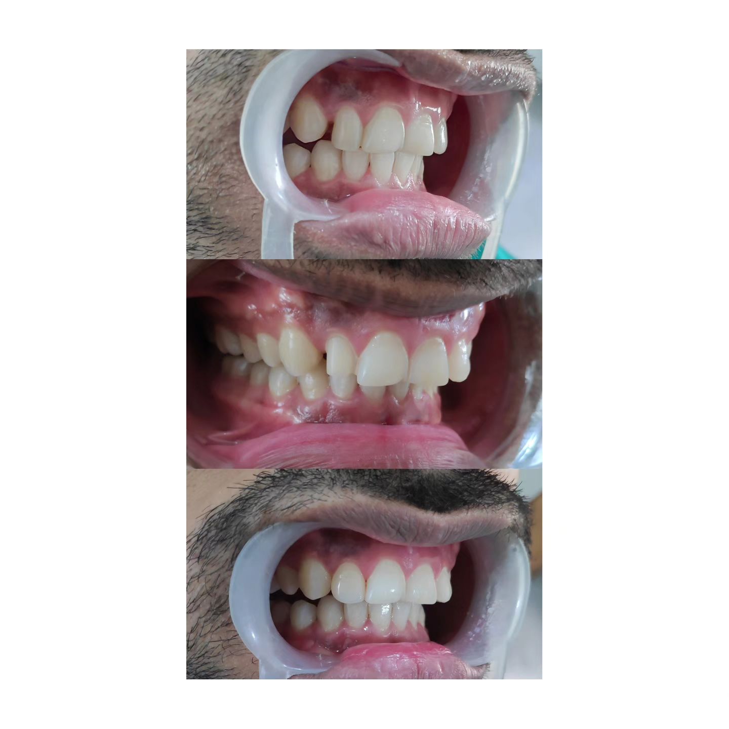 Orazone dental clinic | Vadodara
