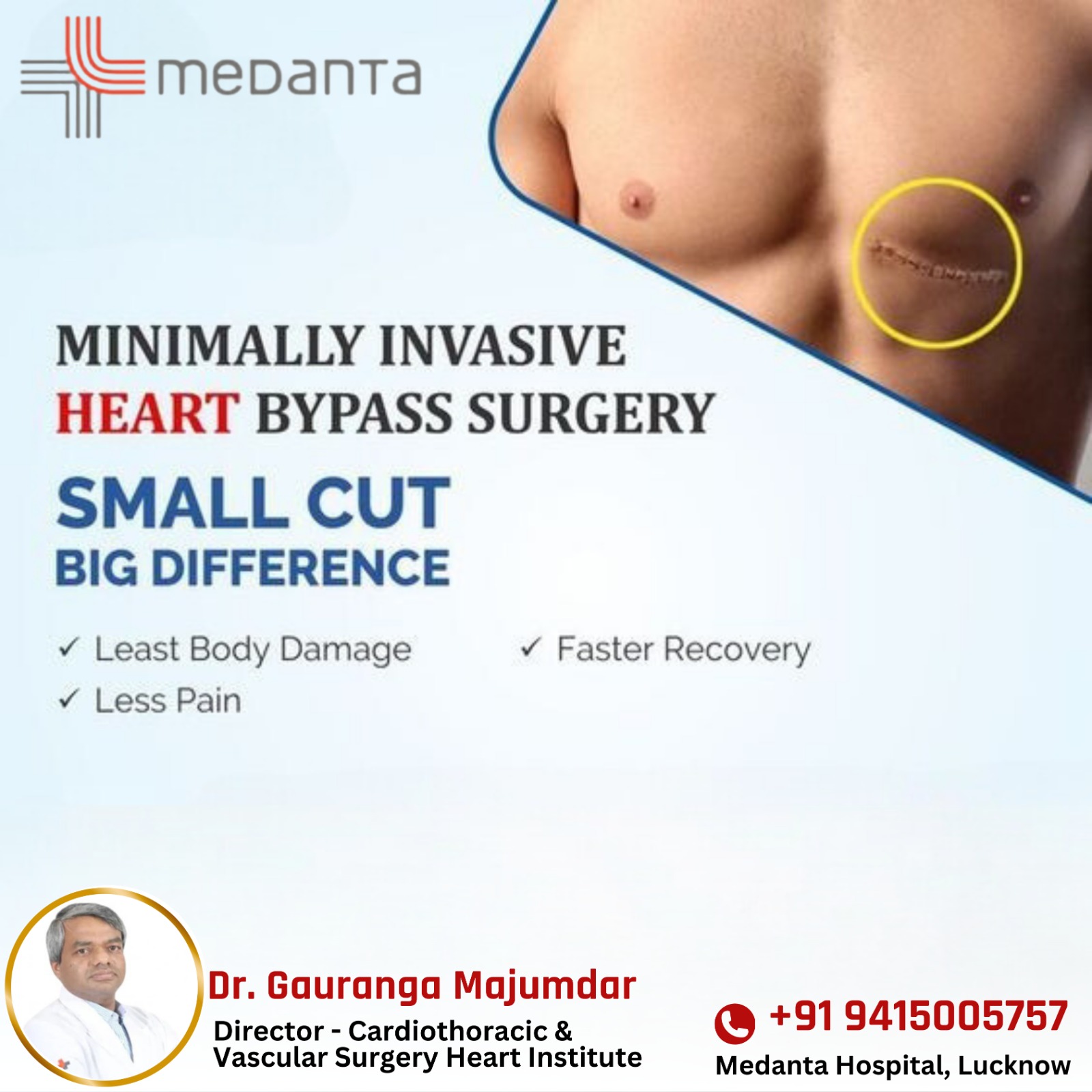 Minimally invasive heart bypass surgery: a small cut that makes a