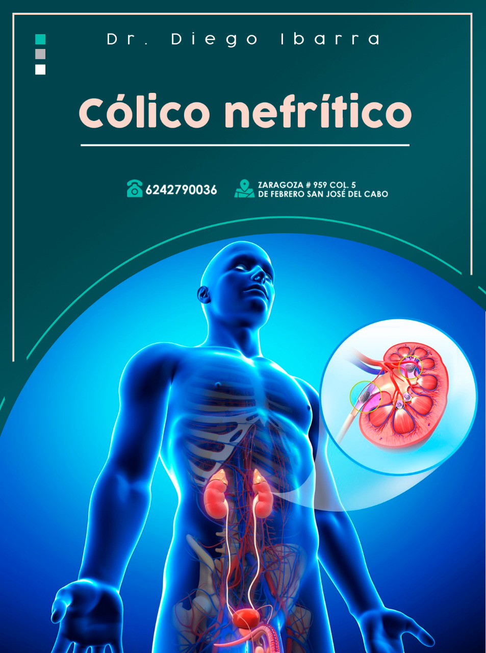 Urología - Dr. Diego Iván Ibarra Pérez - 🟥 El cólico nefrítico es el ...