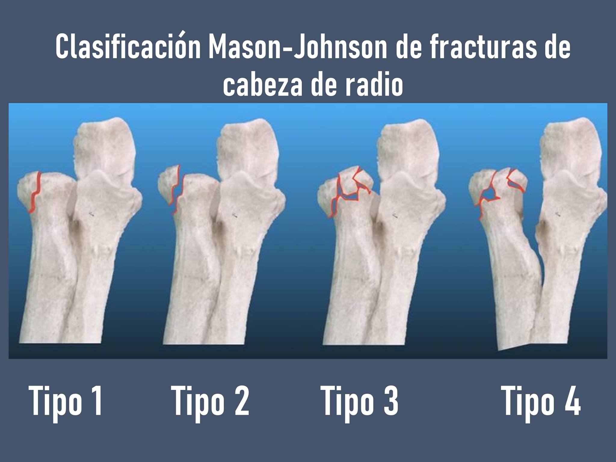 Clasificación... - Tecnologia Medica-Imagenologia | Facebook