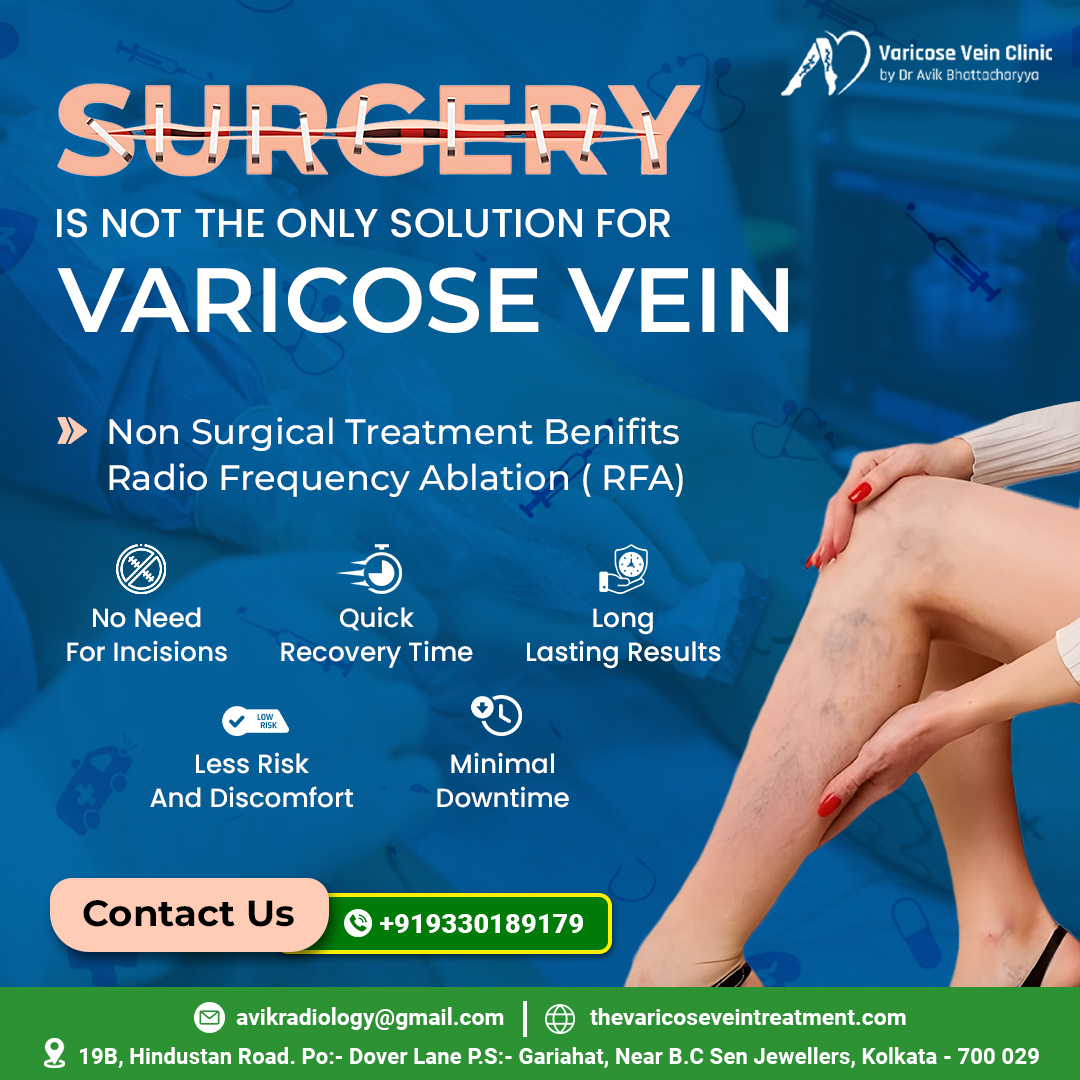 Interventional - Non-Surgical Solution for Varicose Veins Surgery isn't ...