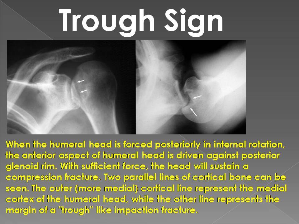 TROUGH SIGN - Radiology Classroom