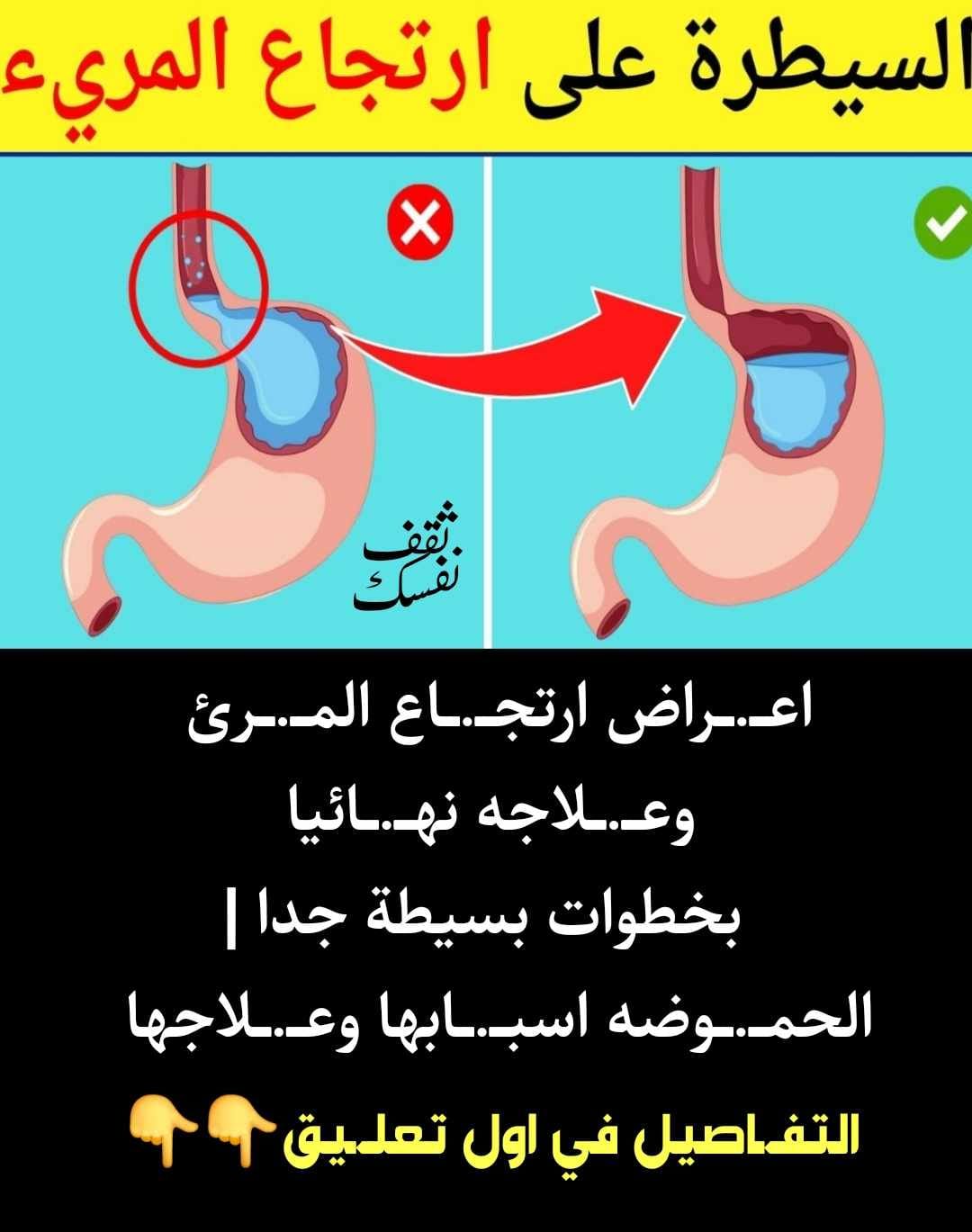 ثقف نفسك - اعــ.ــراض ارتجــ.ــاع المــ.ــرئ وعــ.ــلاجه...
