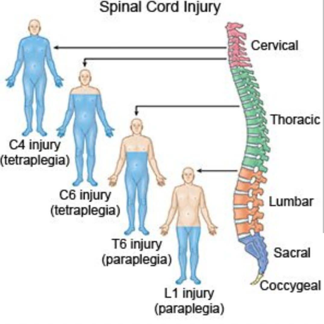 human-anatomy-group-spinal-cord-injuries-facebook