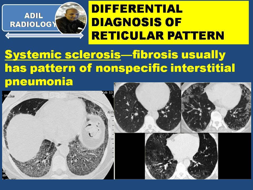 DIFFERENTIAL DIAGNOSIS OF RETICULAR... - Radiology Classroom