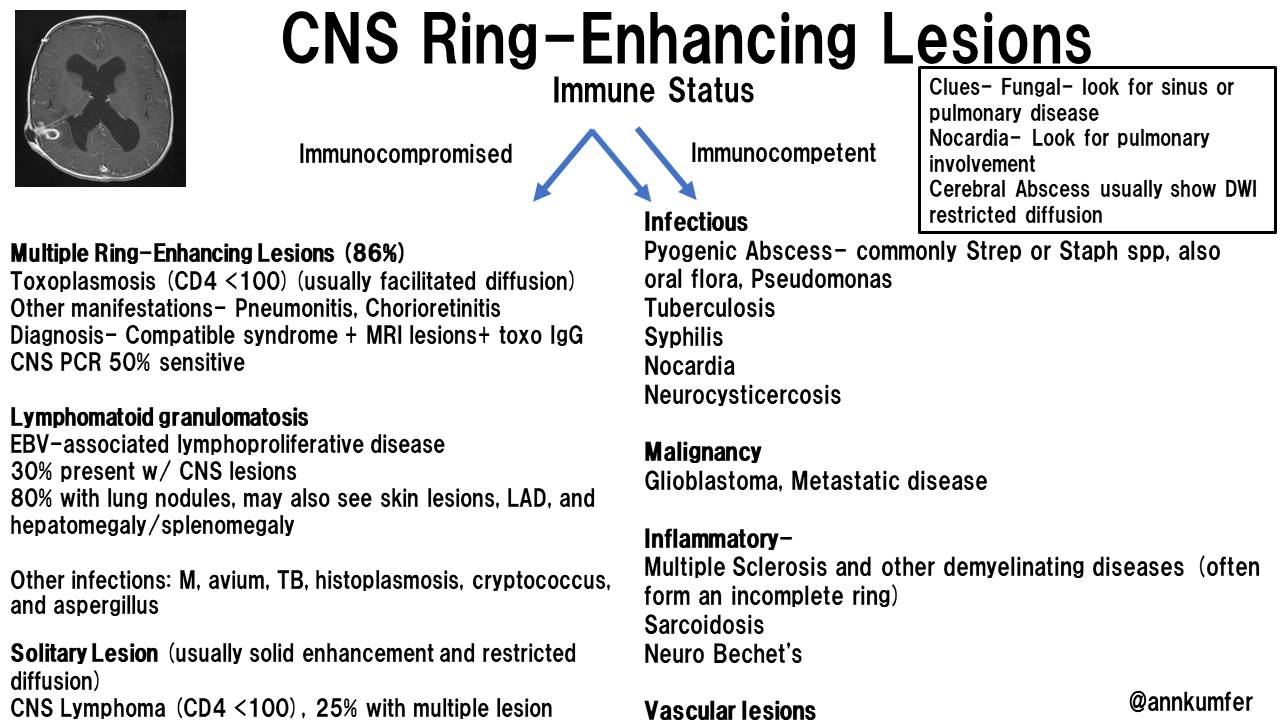 Neurology - Ring 💍 enhancement lesions | Facebook