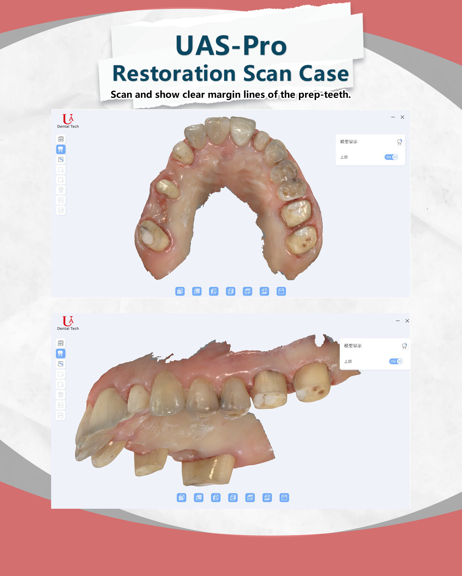 Foshan - UAS-Pro Restoration Scan Case Scan and show clear margin lines ...