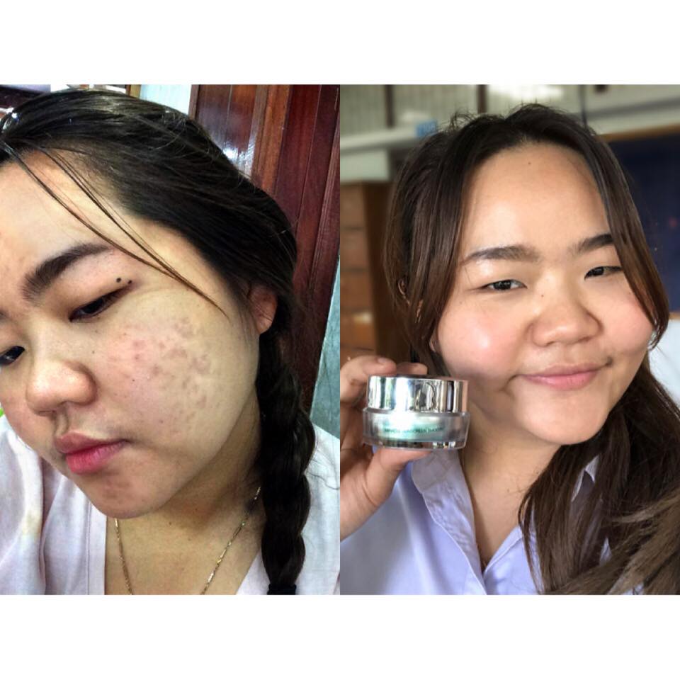 Unique Miracle... - Unique เพื่อสุขภาพและความงาม