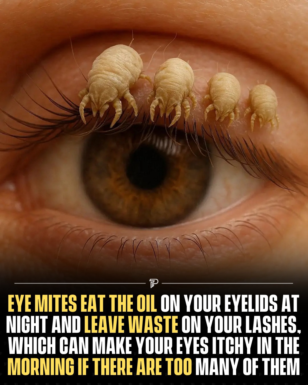 Pubity - Microscopic organisms called eye mites, scientifically known ...