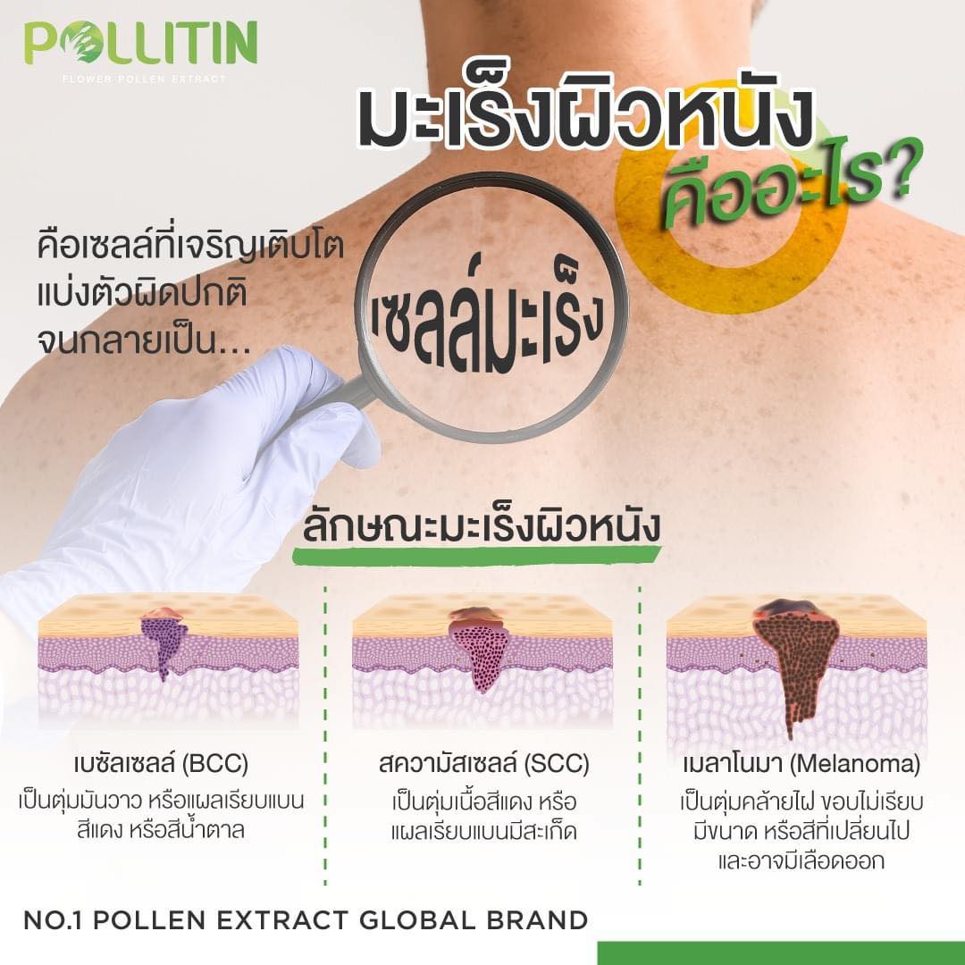 #มะเร็งผิวหนั... - Pollitin - พอลลิติน สารอาหารบำบัดระดับเซลล์ | Facebook