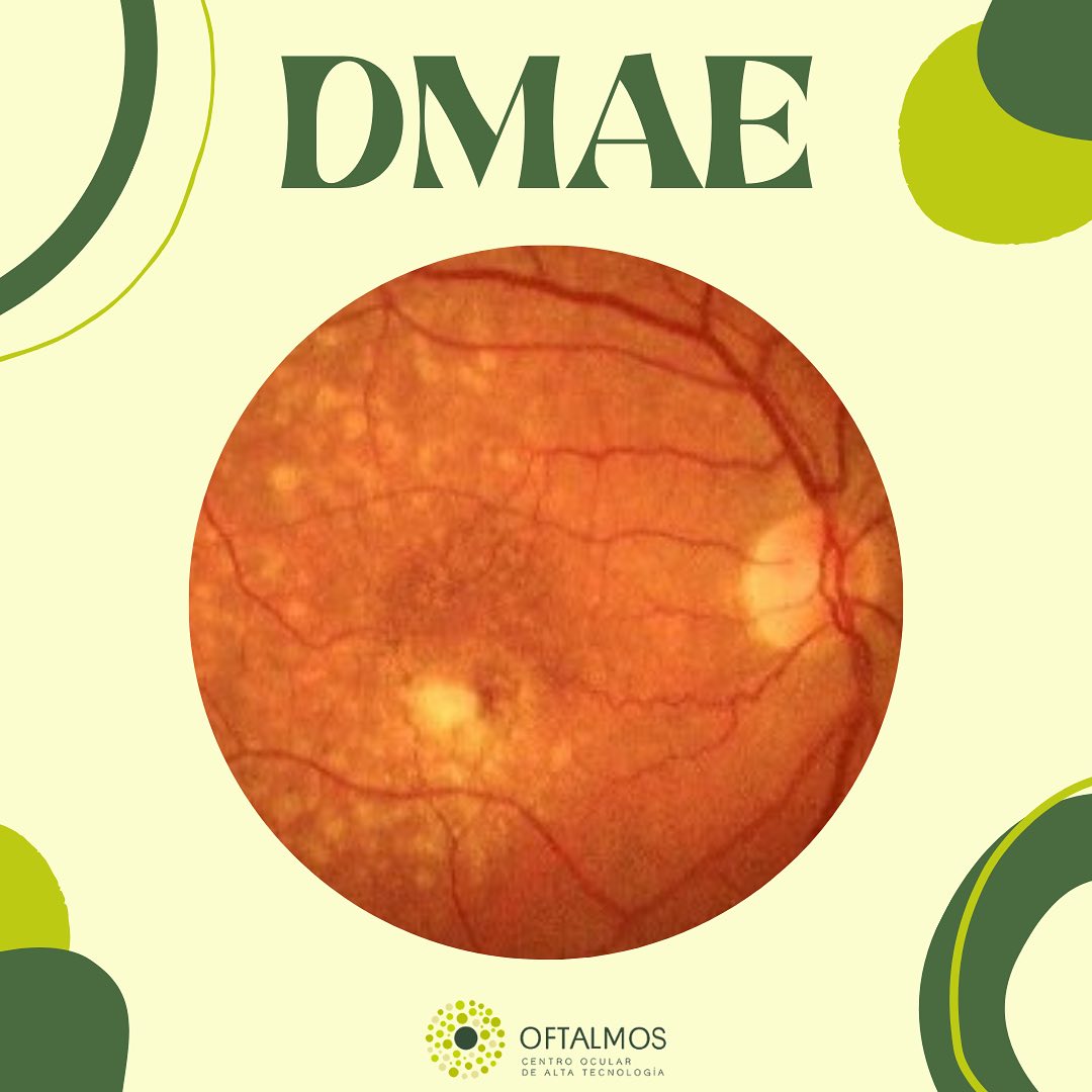 Oftalmos... - Oftalmos Centro Ocular de Alta Tecnología