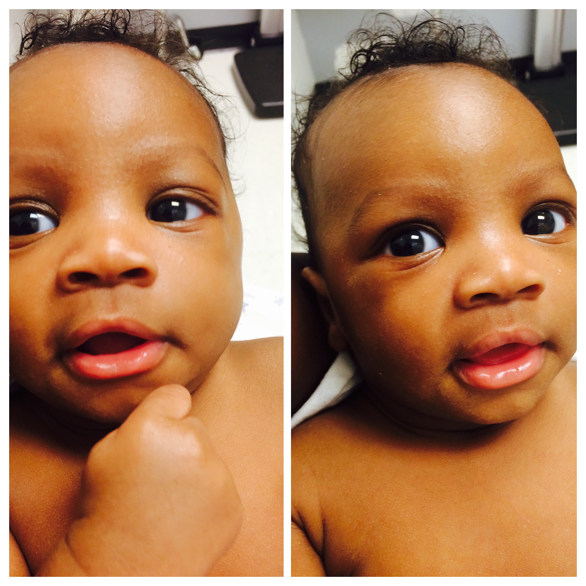 TeiMari - my poor baby forehead so big 󾌴 that's my lovebug tho ️