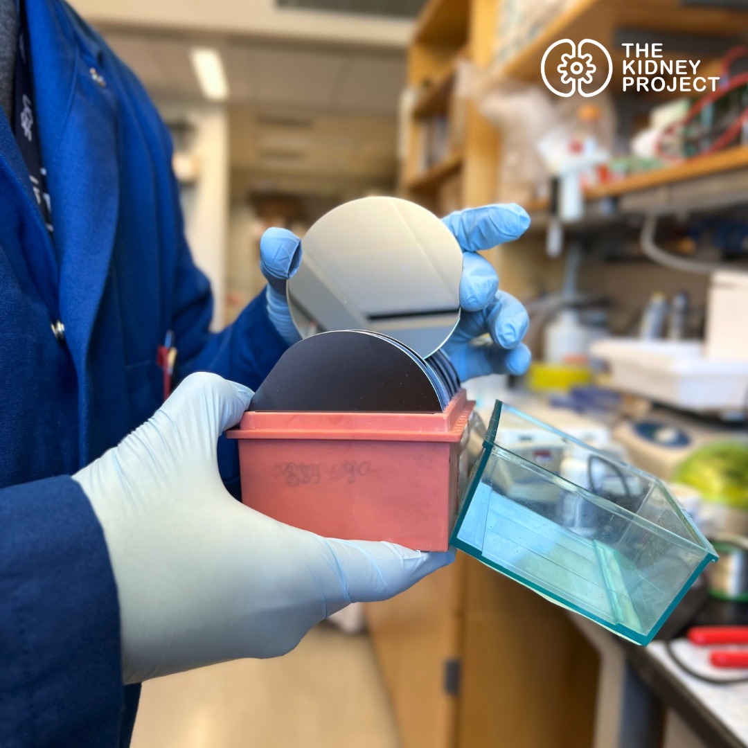 The Kidney Project - The photo shows bare silicon wafers, which are ...