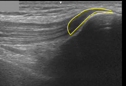 The POCUS Preceptor | Northampton MA