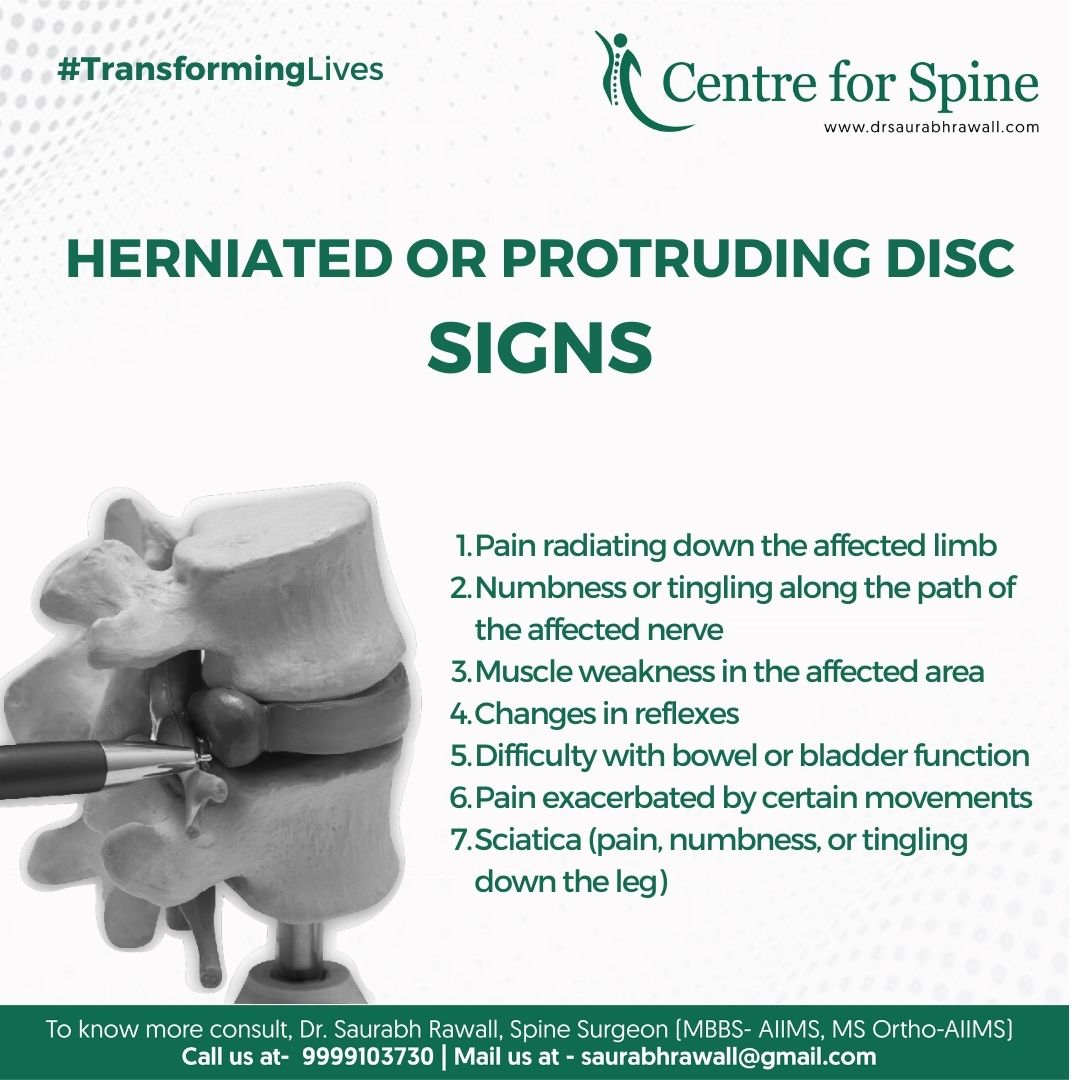 Dr. - HERNIATED OR PROTRUDING DISC SIGNS: - Pain radiating down the ...
