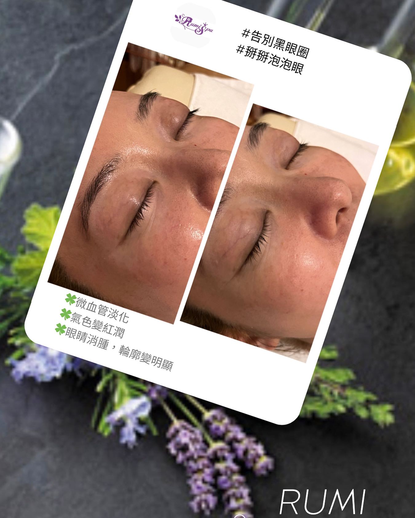 RUMI - Spa & Beauty Care | Taipei