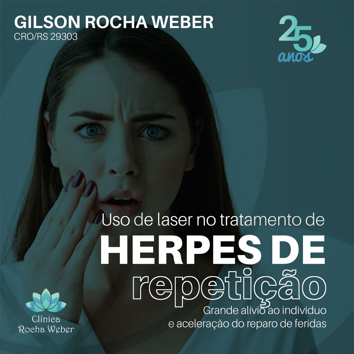 O vírus herpes simples (HSV) é o... - Clínica Rocha Weber