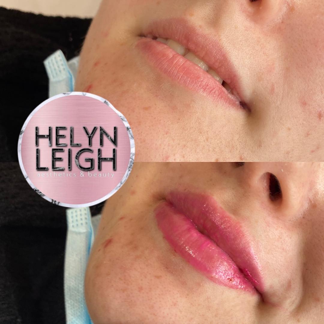 💋💋💋 GIRL THESE ARE... - Helyn Leigh Aesthetics & Cosmetics | Facebook