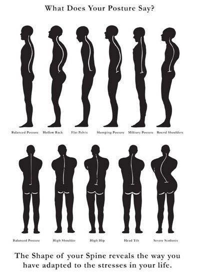 Chiropractic Clinics of Puerto Rico - -¿Qué revela tu postura? -La ...