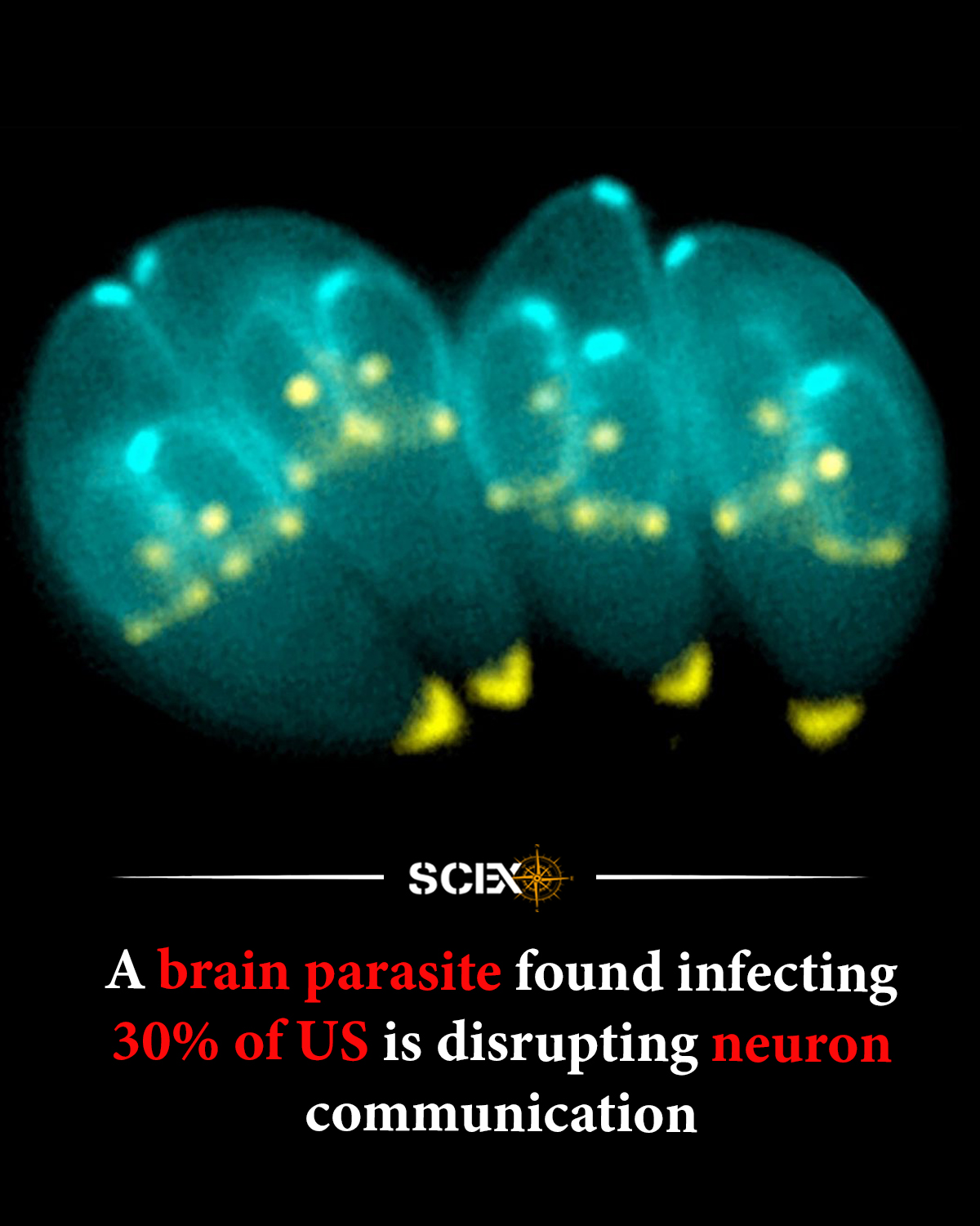 Science - A microscopic parasite may be doing more inside the brain ...