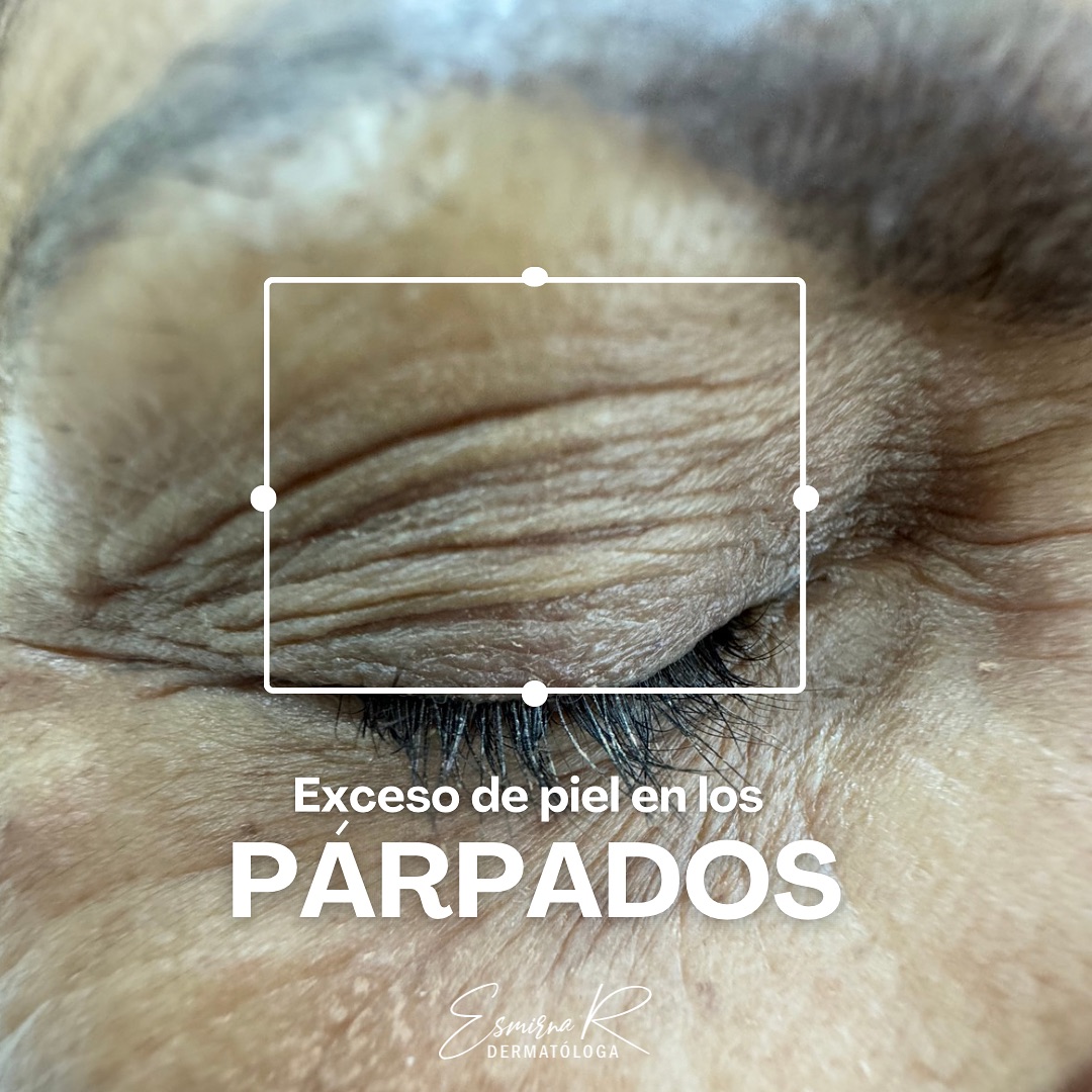 Roderma - Centro de Dermatología y Medicina Estética