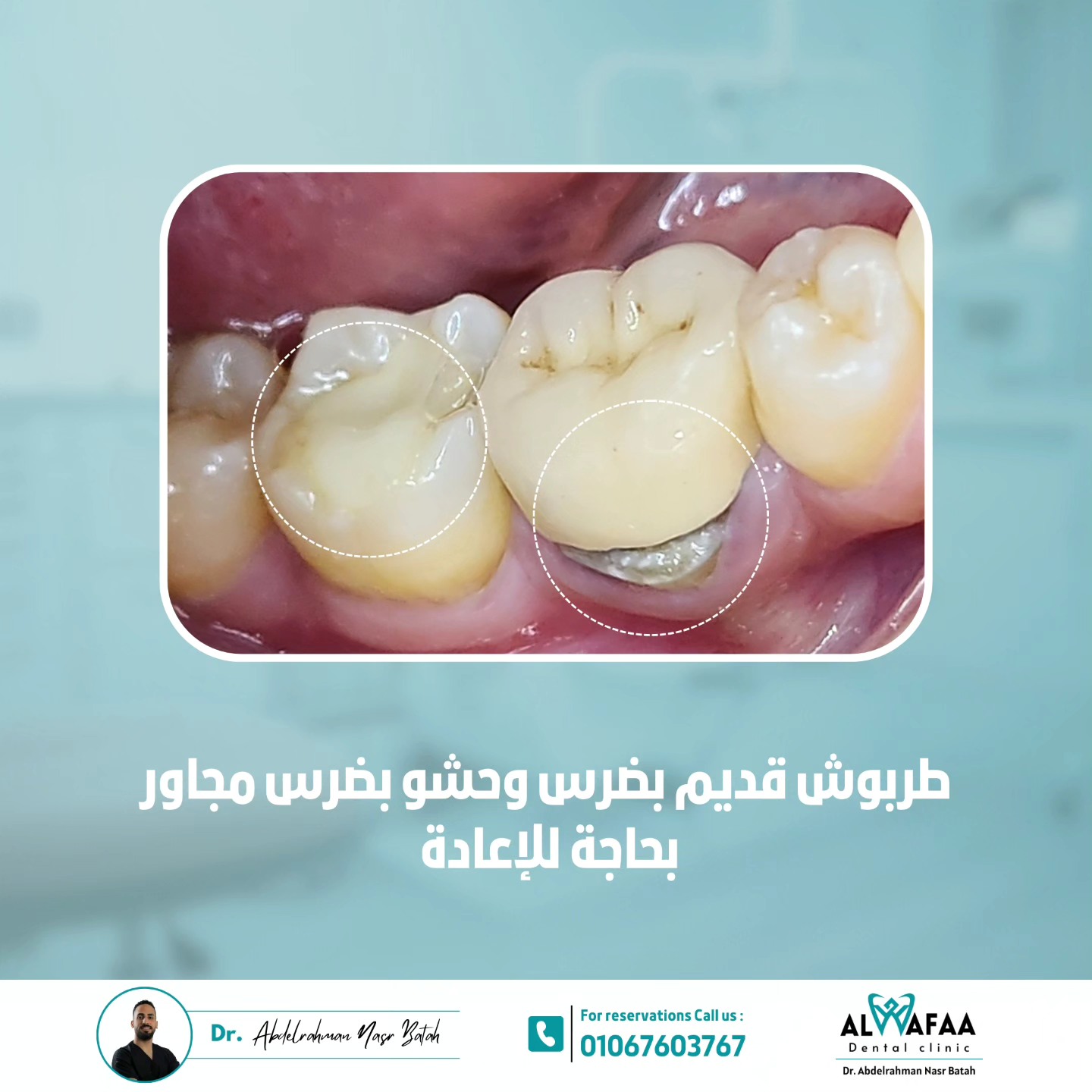 Dr. Abdelrahman Nasr Batah - د. عبدالرحمن نصر بطاح | Qalyub