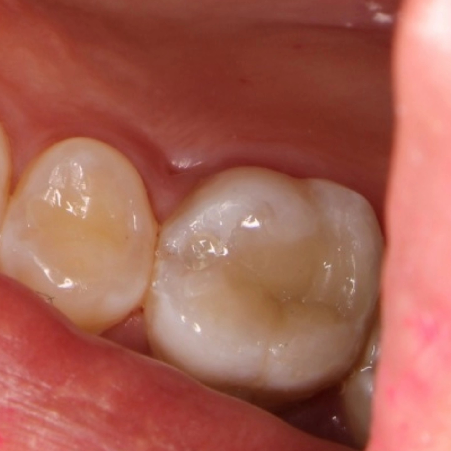 Tree Dent Consultorio Dental | Tuxtla Gutiérrez