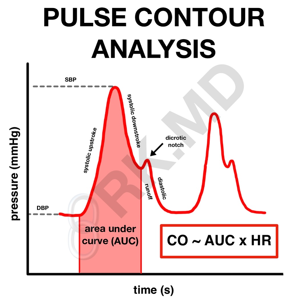 Rishi Kumar, MD - Pulse contour analysis was described... | Facebook