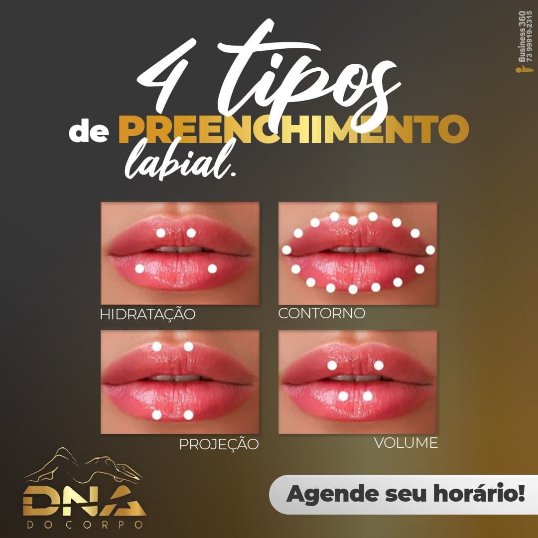 dnadocorpo - ⚜️ O preenchimento labial vai além de proporcionar lábios ...