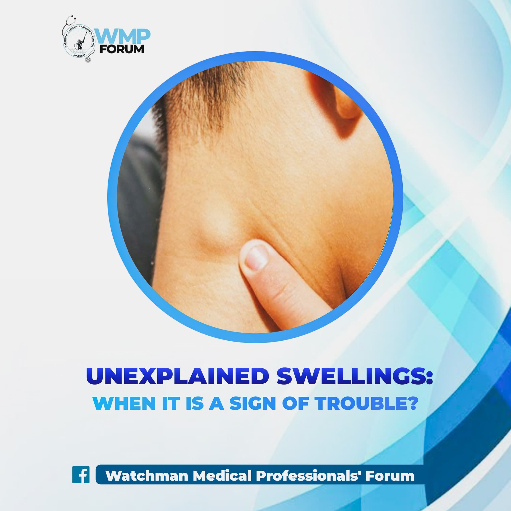 Watchman - UNEXPLAINED SWELLINGS: WHEN IS IT A SIGN OF TROUBLE? Chioma ...