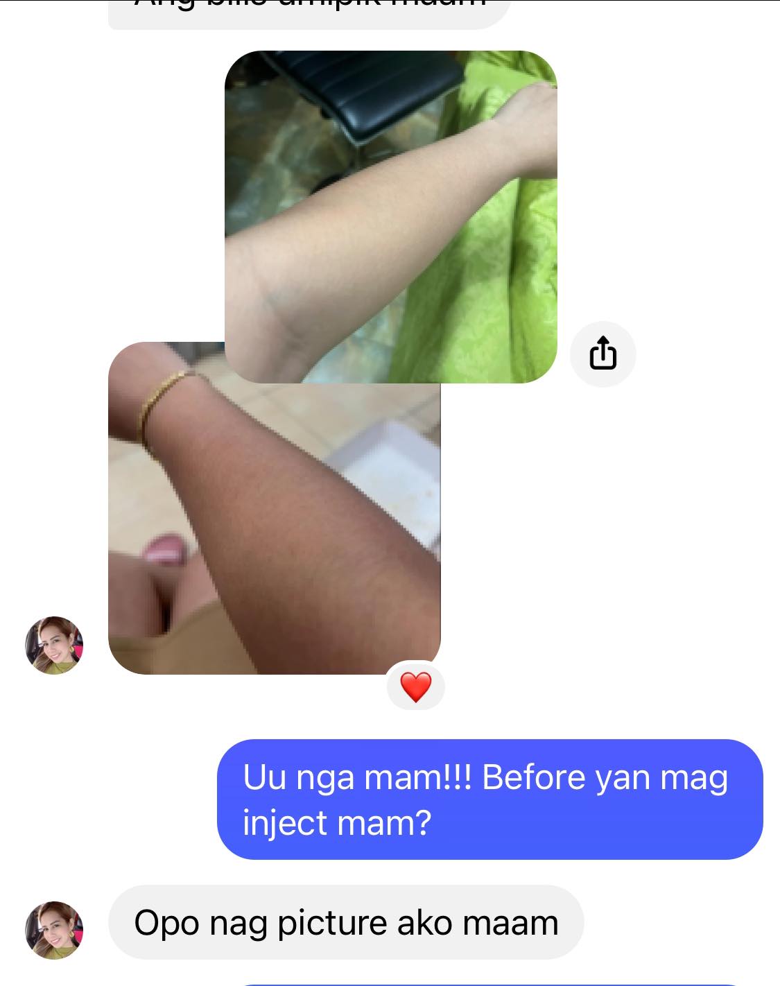 Reyna Gluta Drip | Caloocan