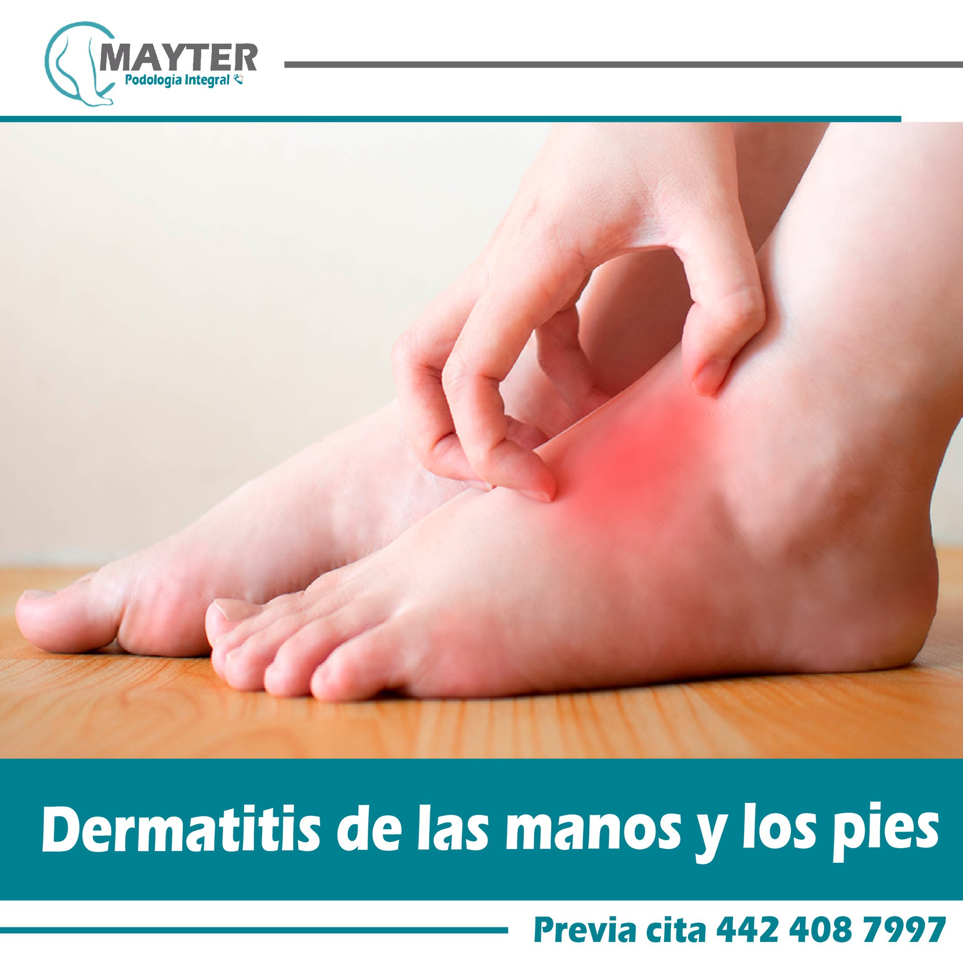 Dermatitis... - Podologia Integral Mayter Enfermera y Podologa | Facebook