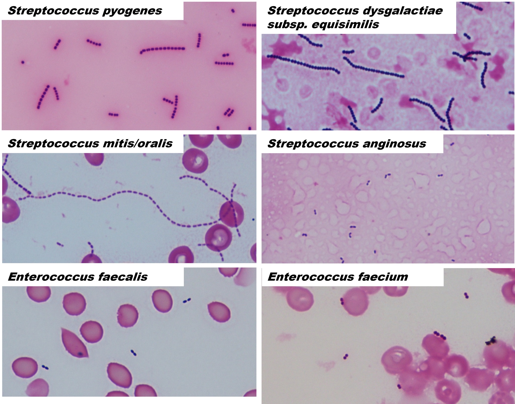 飯塚病院 感染症科 - 【感染症カンファレンスのご紹介！Streptococcus mitis/oralis】 ... | Facebook
