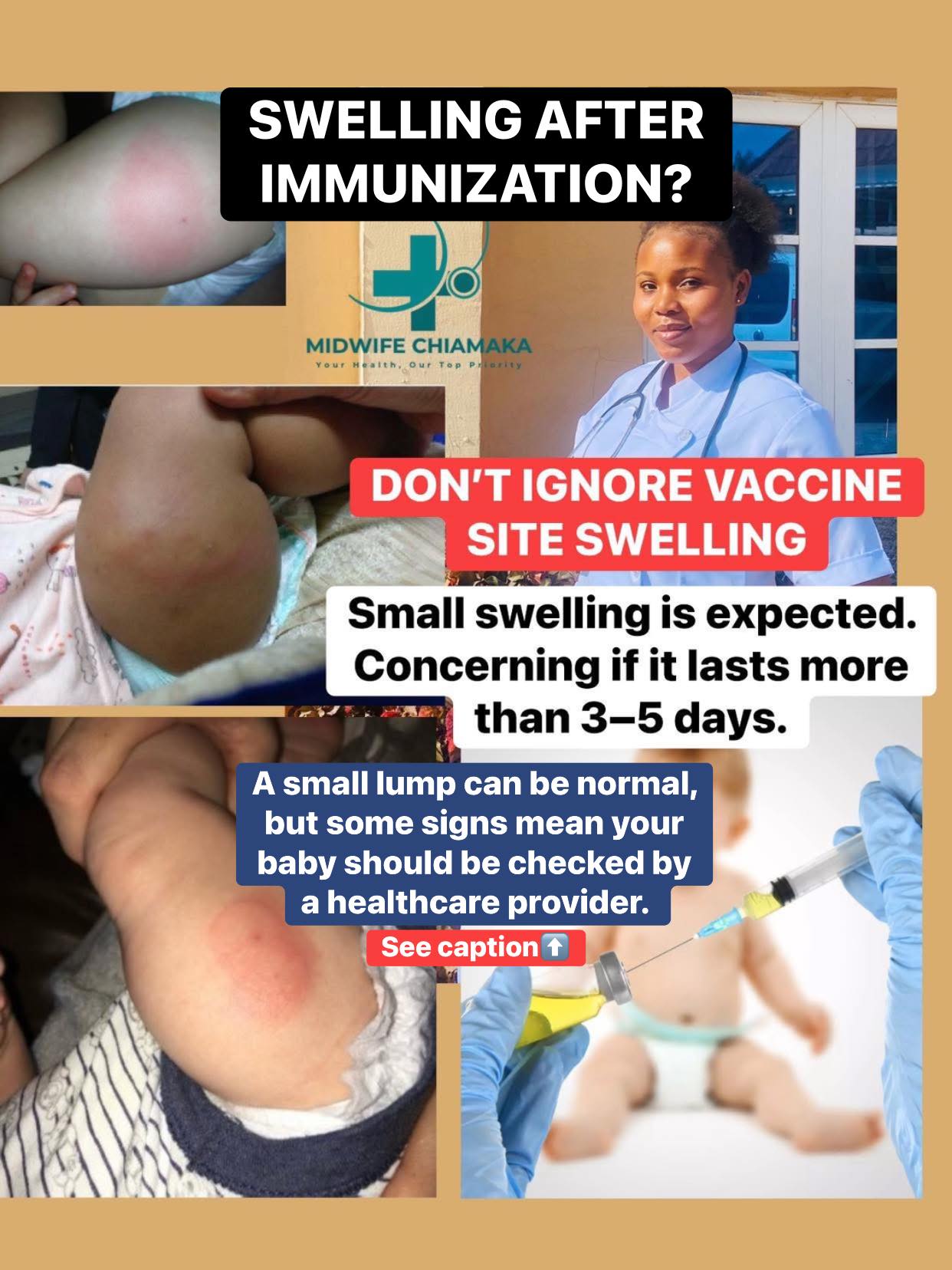 lump after b12 injection What to do about a hard baby's injection? Size:1000 mcg/ml - 30 ml (Pack of 3) Methylcobalamin Injection - Liquid DENTAL CITY