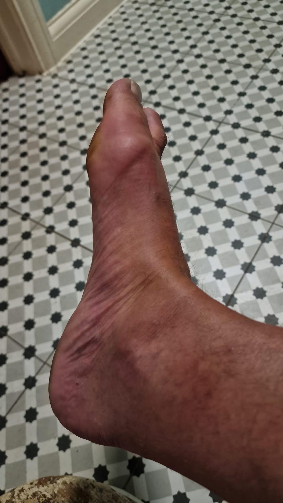 bpc-157 gout Can Fix Your Gut and Joints? How BPC-157 is Secretly Healing