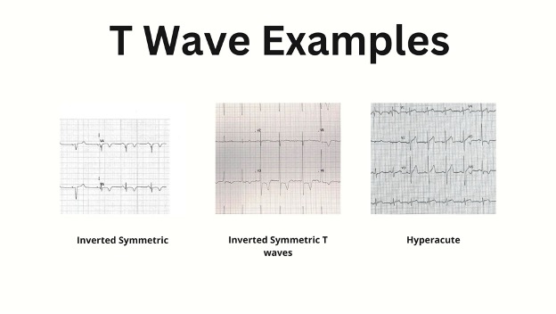 EB Medicine - From electrolyte status to an enlarged heart... | Facebook