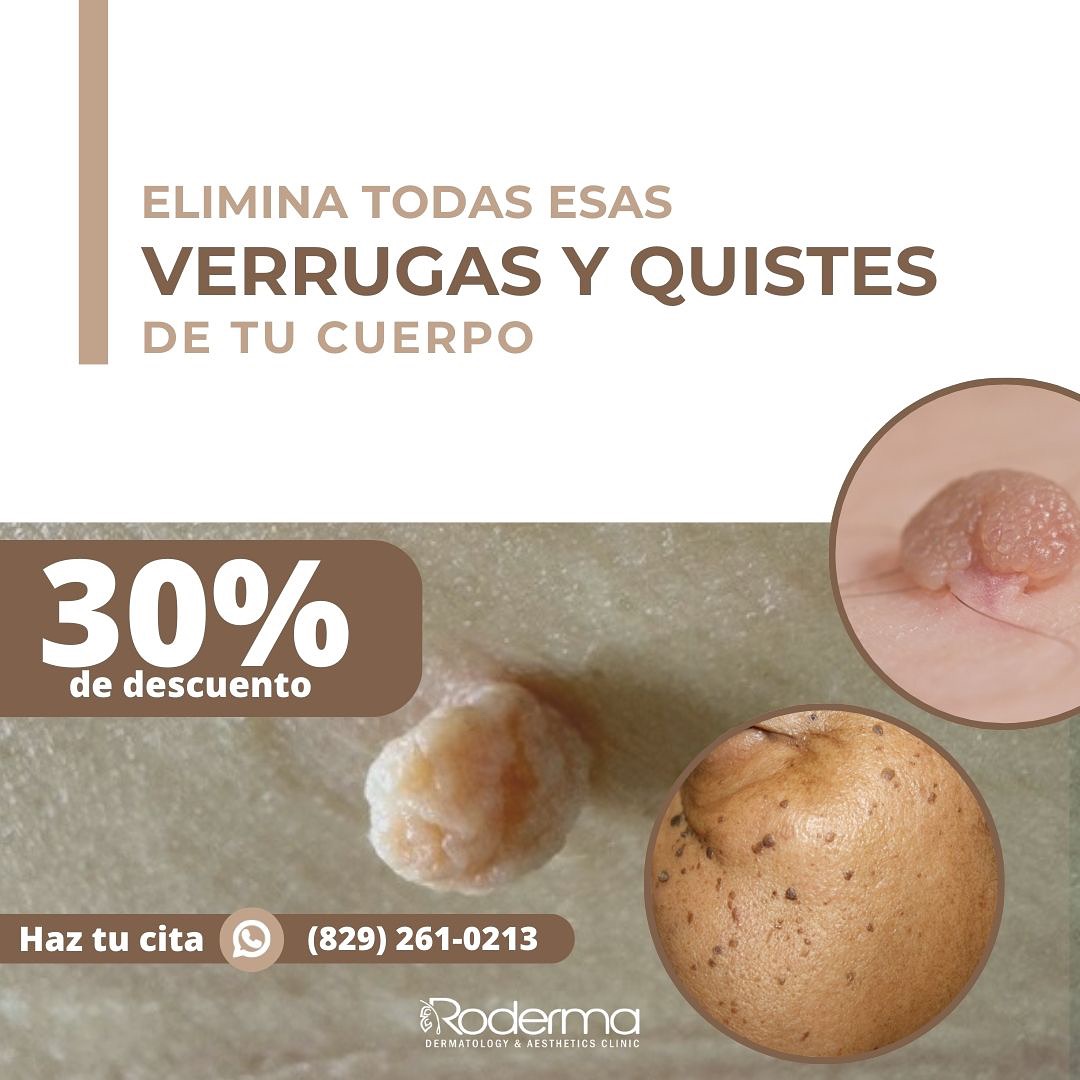 Roderma - Centro de Dermatología y Medicina Estética