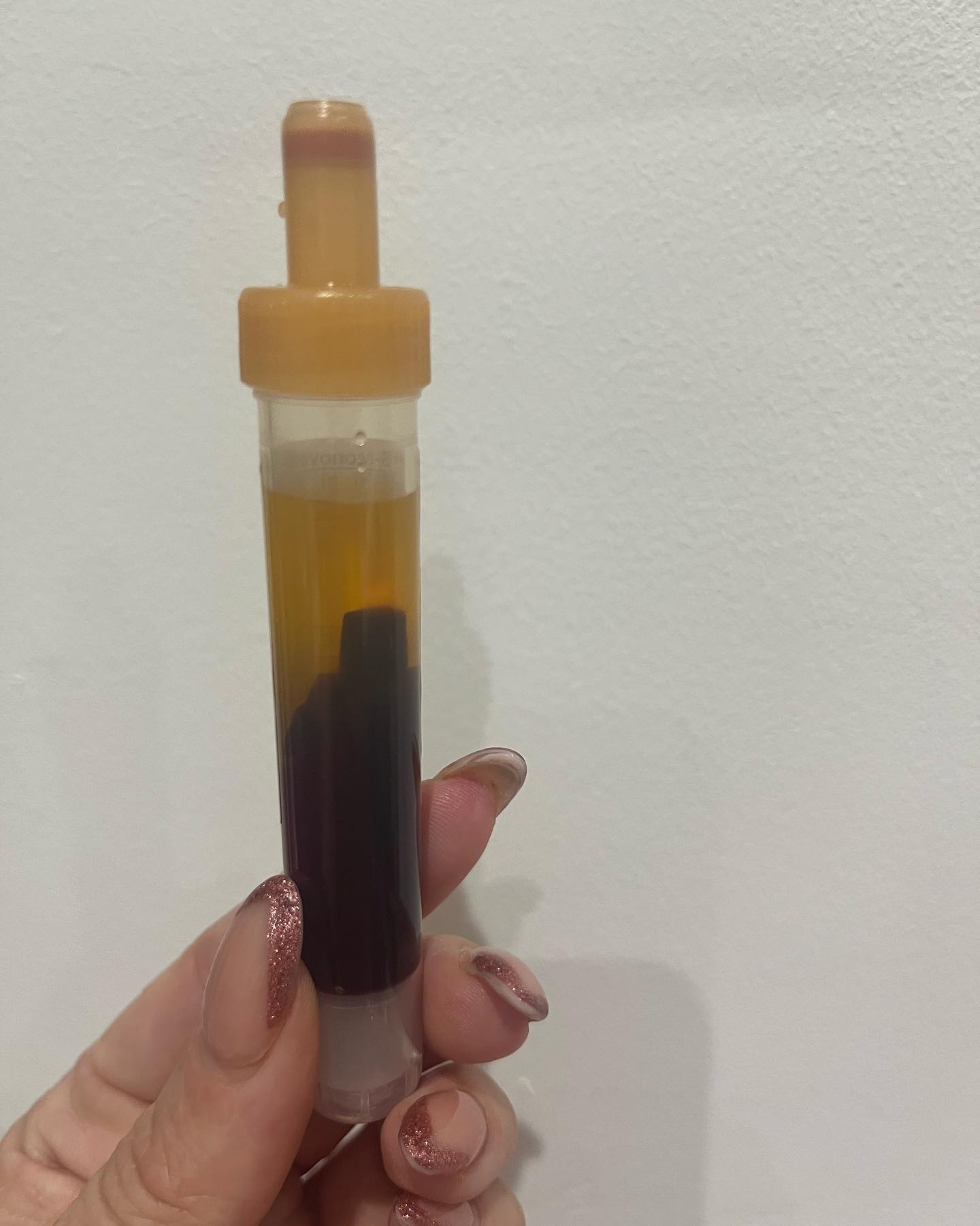 Enhance - 🩸🌡️ PRF / PRP - Facial Rejuvenation / Hair Loss Treatment 🌡️🩸 ...