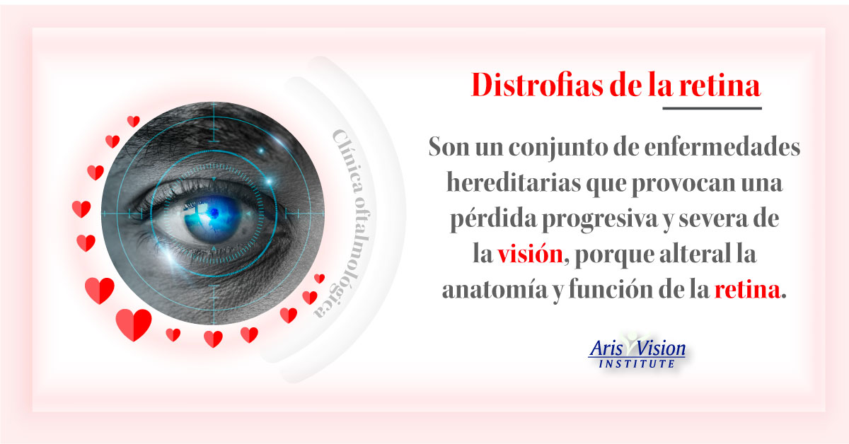 Aris Vision CDMX | Mexico City