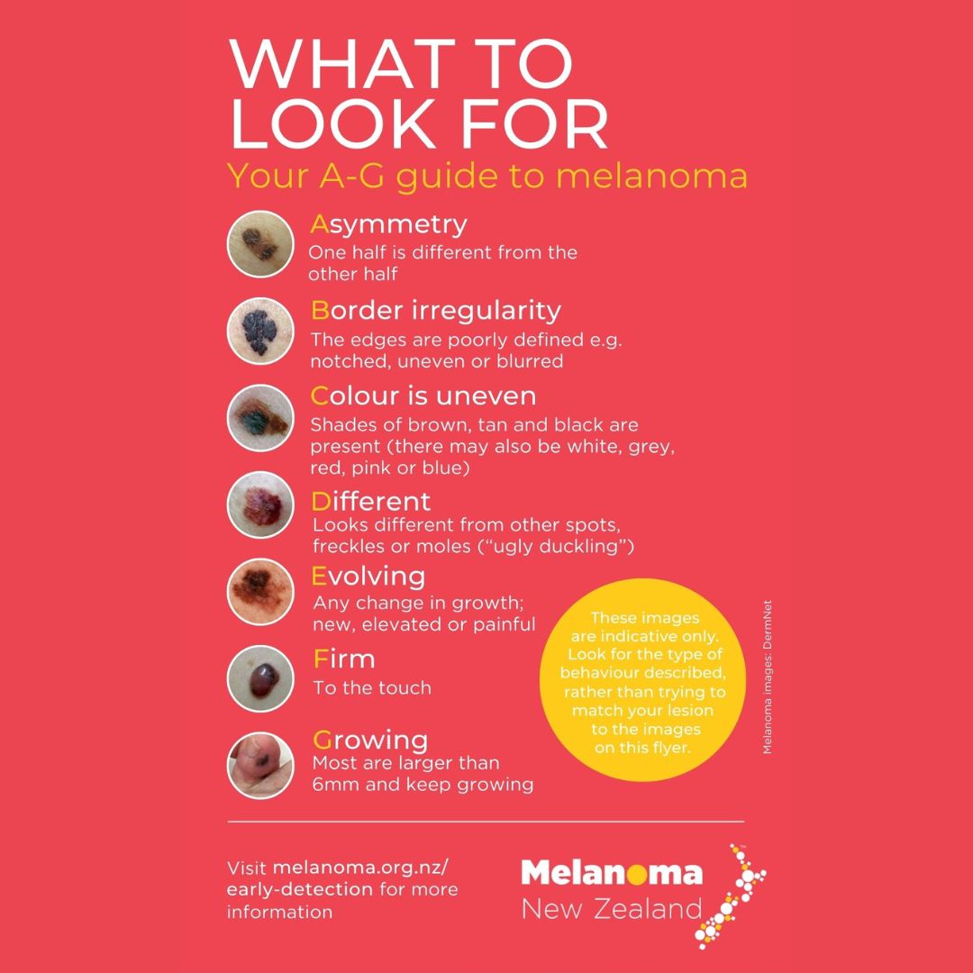 Early detection of skin cancer can... - Melanoma New Zealand
