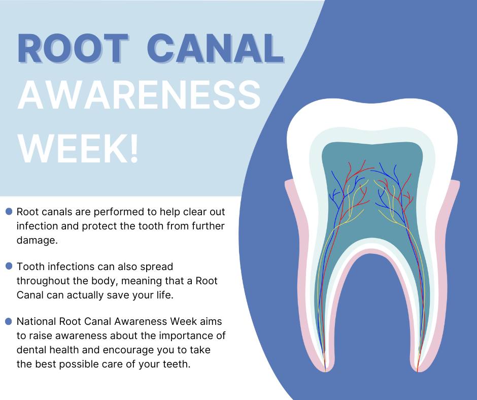 Hammond - 🦷 Root Canal Awareness Week is here! 🎉 Did you know that root ...