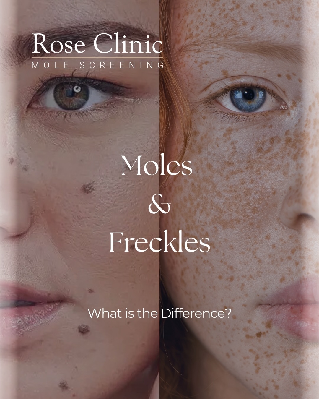 Moles or freckles can you tell the difference? Most are completely harmless, but some skin changes shouldn't be ignored. Knowing what to look for could make all the difference. If you notice