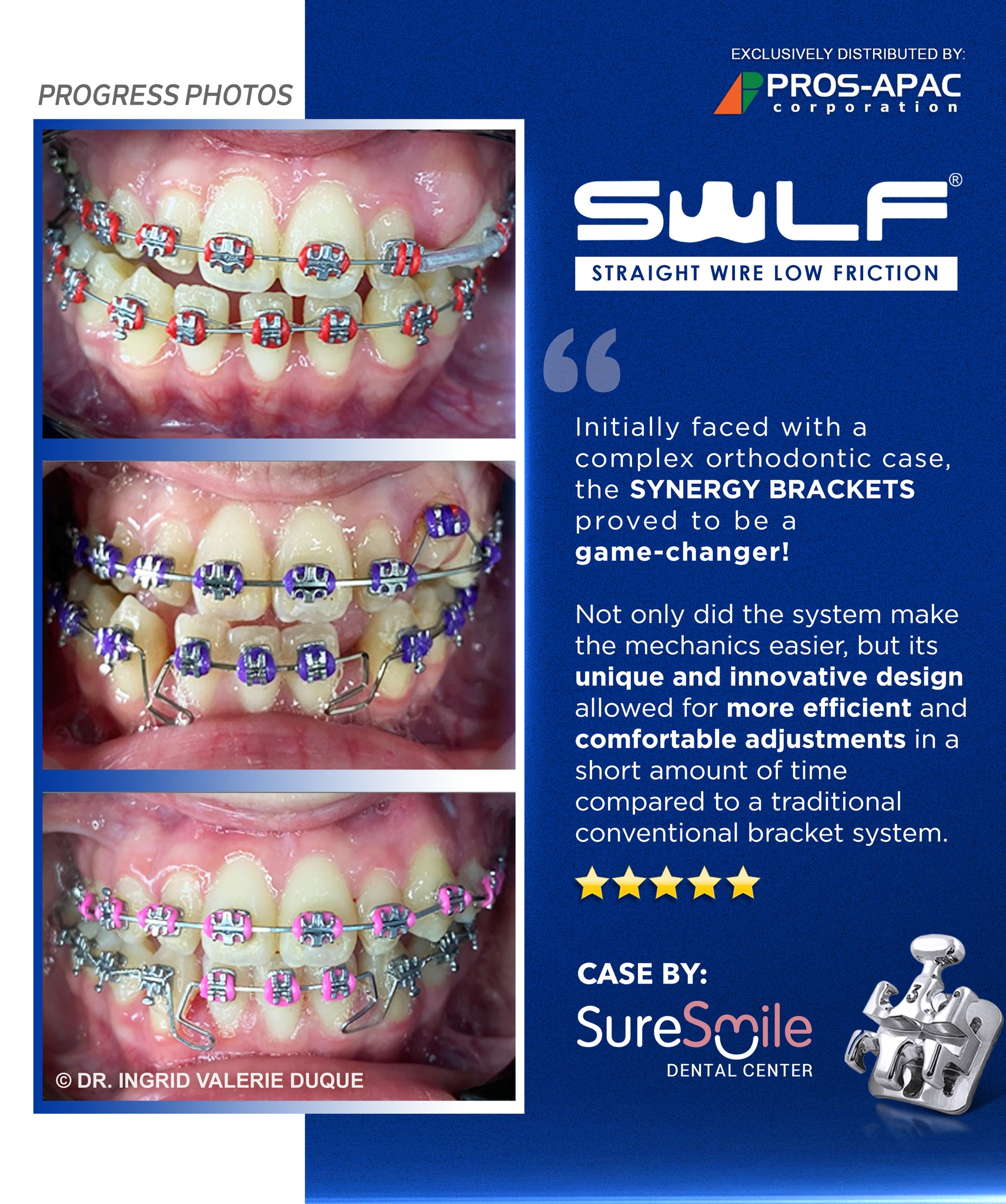 PROS APAC - The 𝗦𝗪𝗟𝗙 𝗦𝗬𝗡𝗘𝗥𝗚𝗬 𝗕𝗿𝗮𝗰𝗸𝗲𝘁 is a game changer in Orthodontics ...