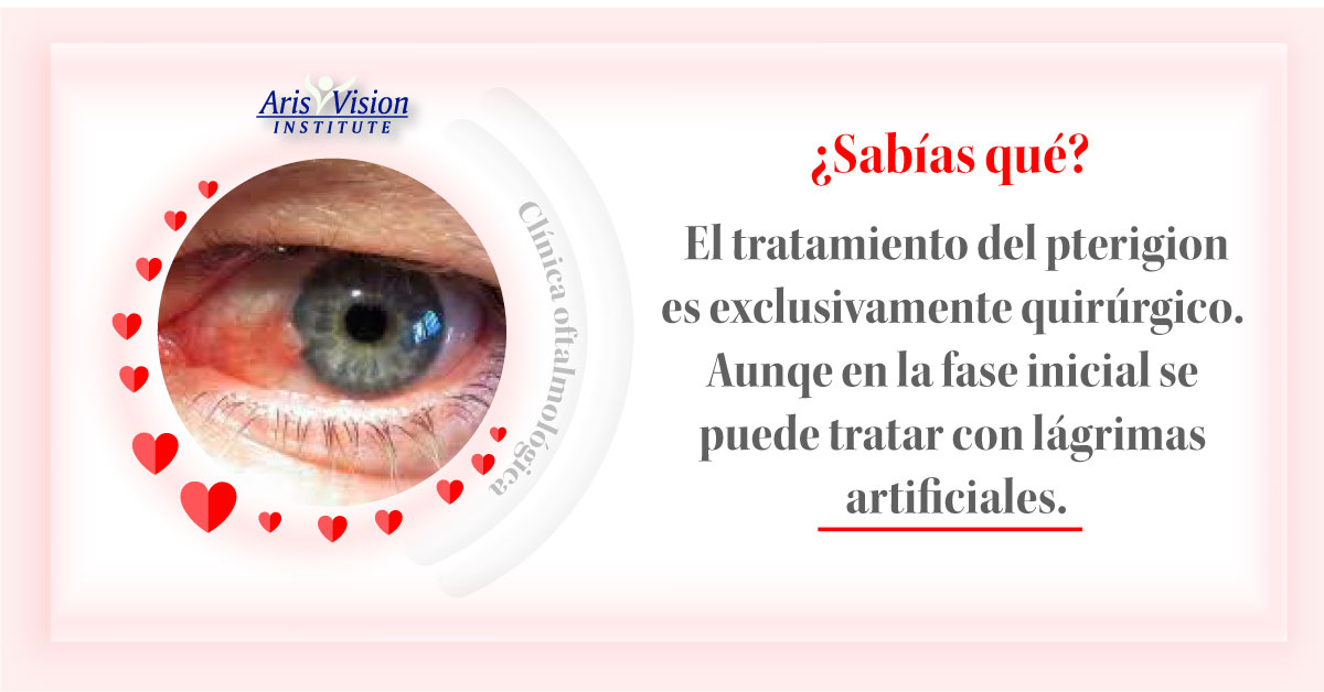 Aris Vision CDMX | Mexico City