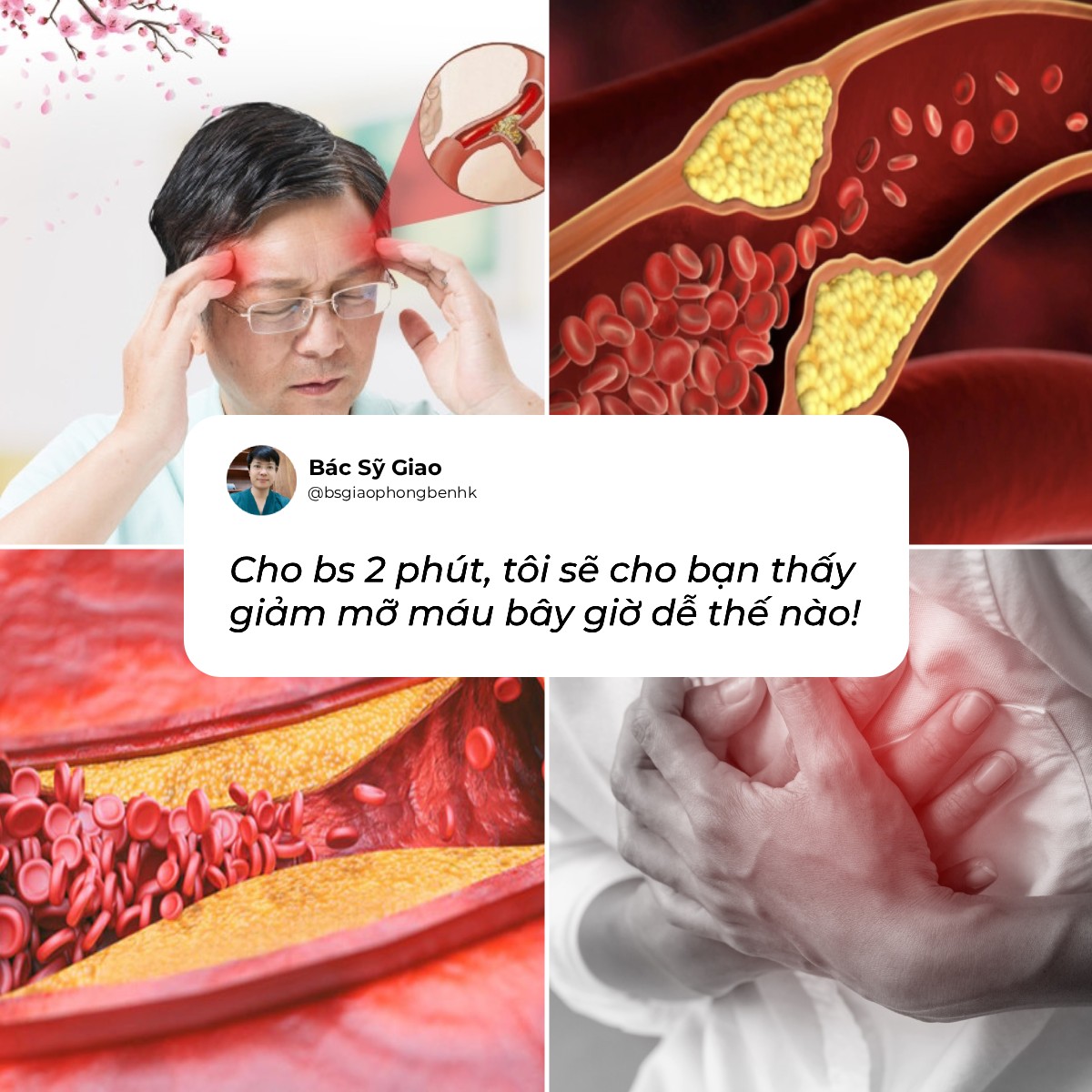Bác - Cho bs xin đúng 2 phút thôi Mình sẽ cho các bác thấy hạ mỡ máu ...