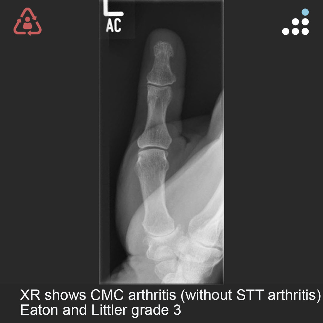 Orthobullets - Here is a new case by Dr. Maximilian...