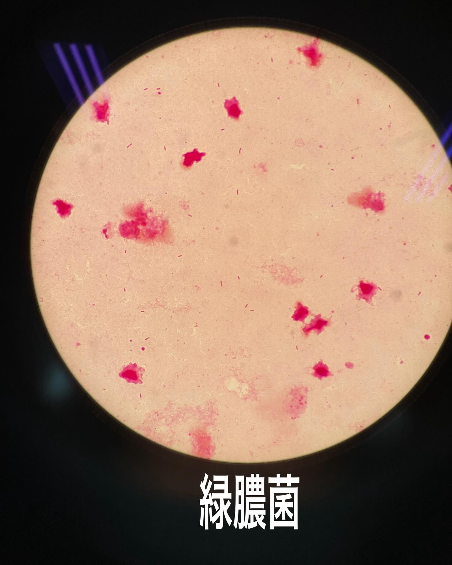 緑 膿 菌